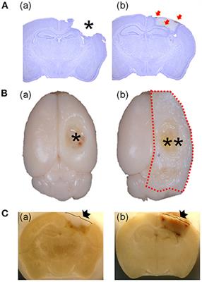Modified Protocol to Enable the Study of Hemorrhage and Hematoma in a Traumatic Brain Injury Mouse Model